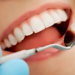 Professional Smile Dentistry Treatment in Miyapur